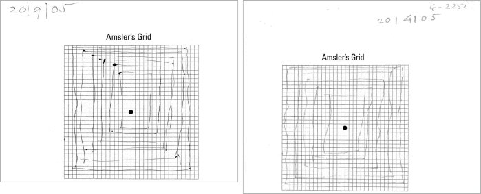 Clinical Study